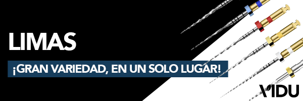 Vidu limas