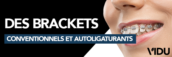 Vidu Brackets