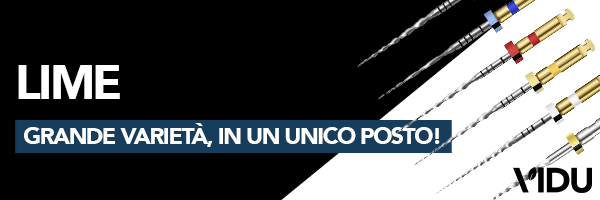 Vidu limas