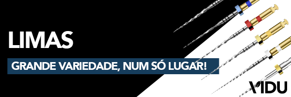 Vidu limas