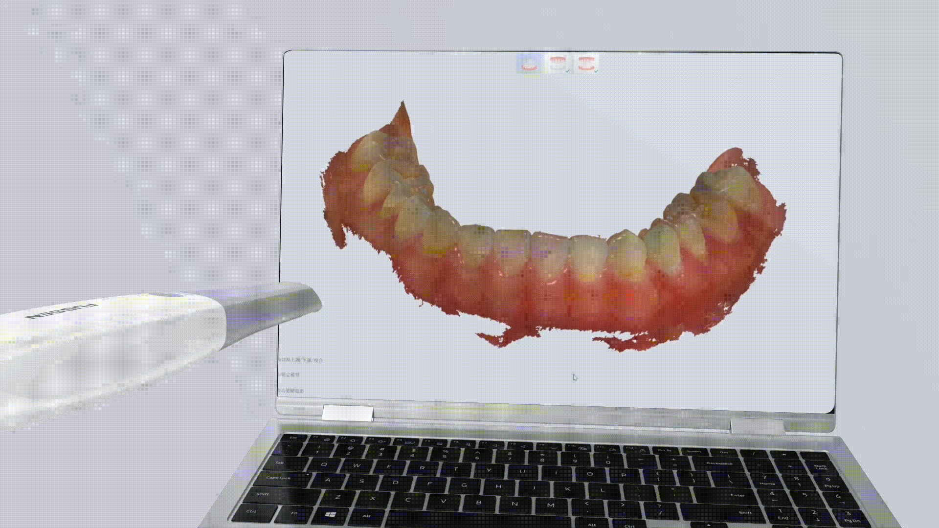 Escaner intraoral Fussen S6500