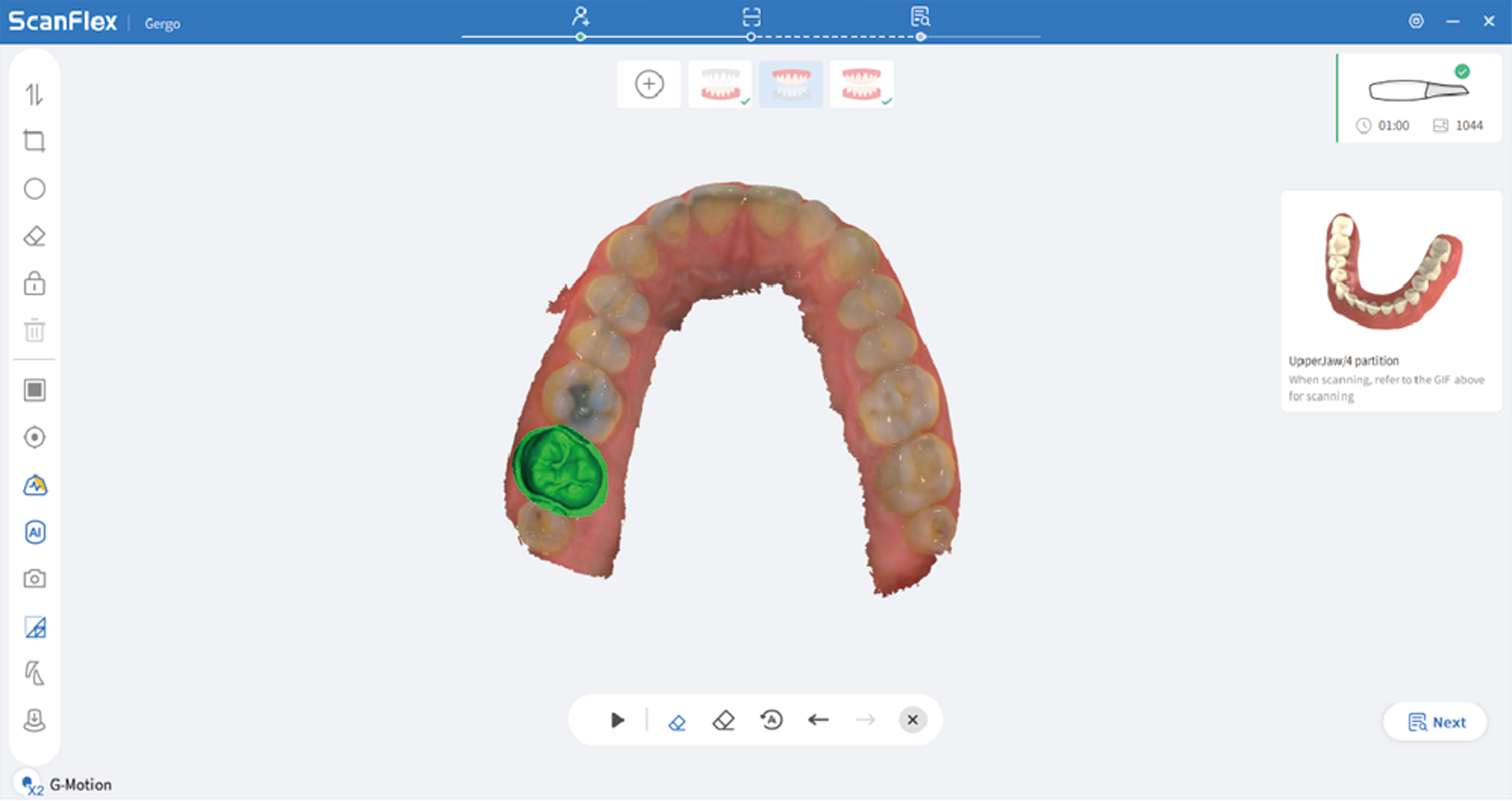 Escaner intraoral Fussen S6500