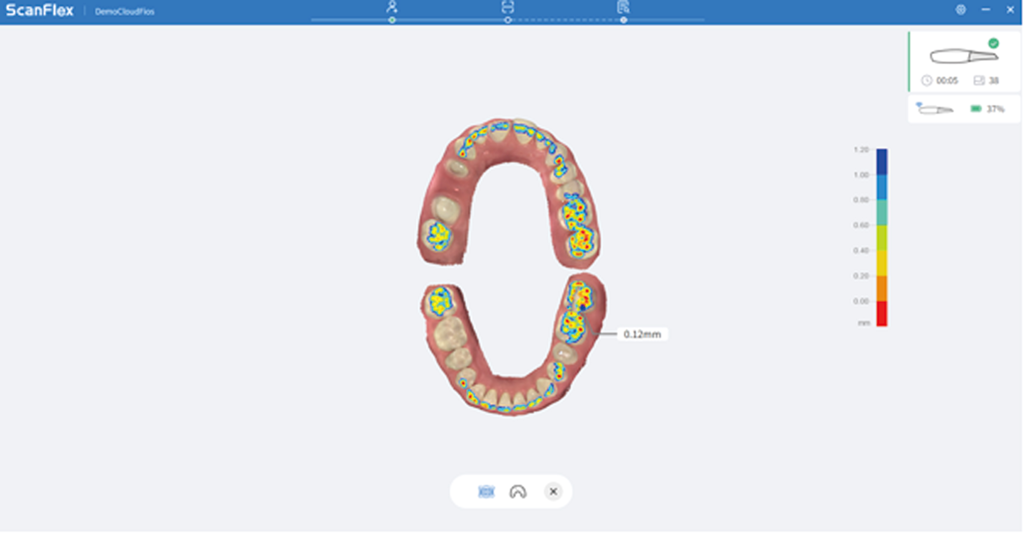 Escaner intraoral Fussen S6500