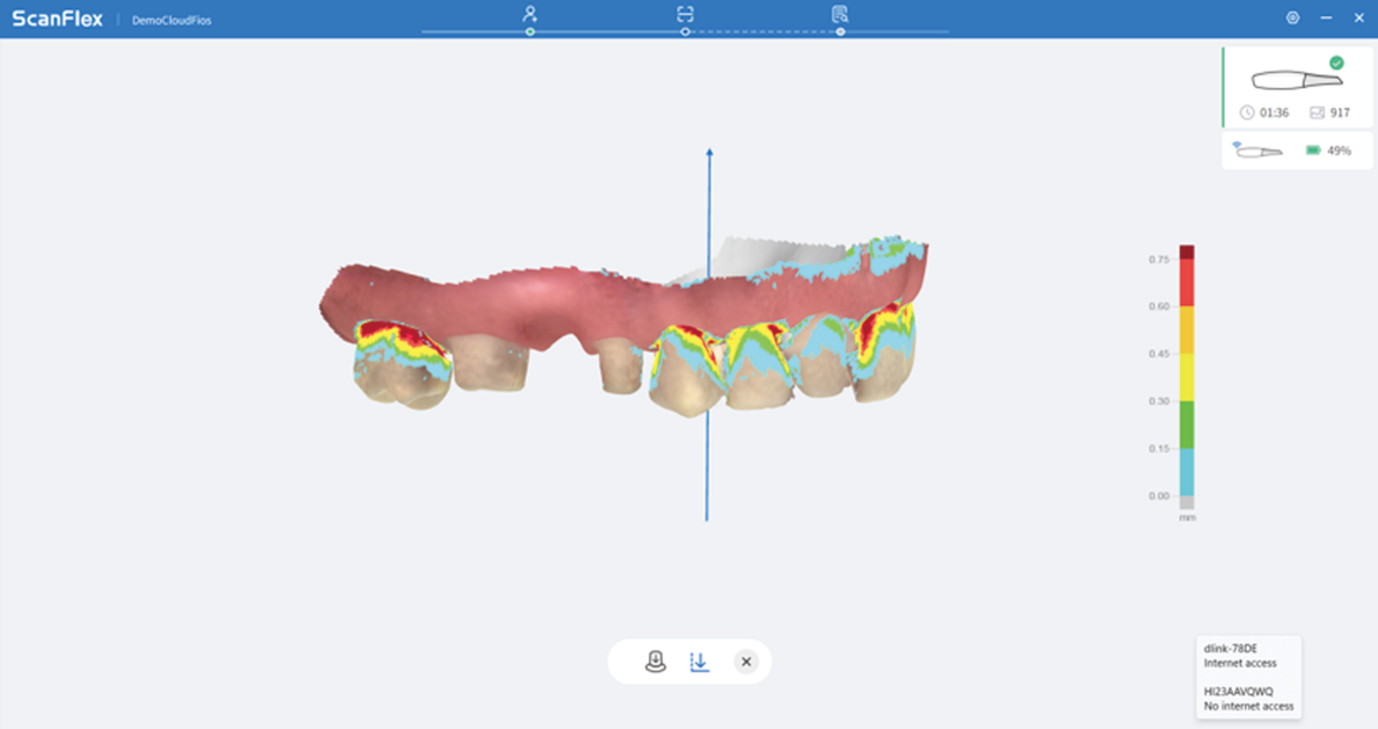 Escaner intraoral Fussen S6500