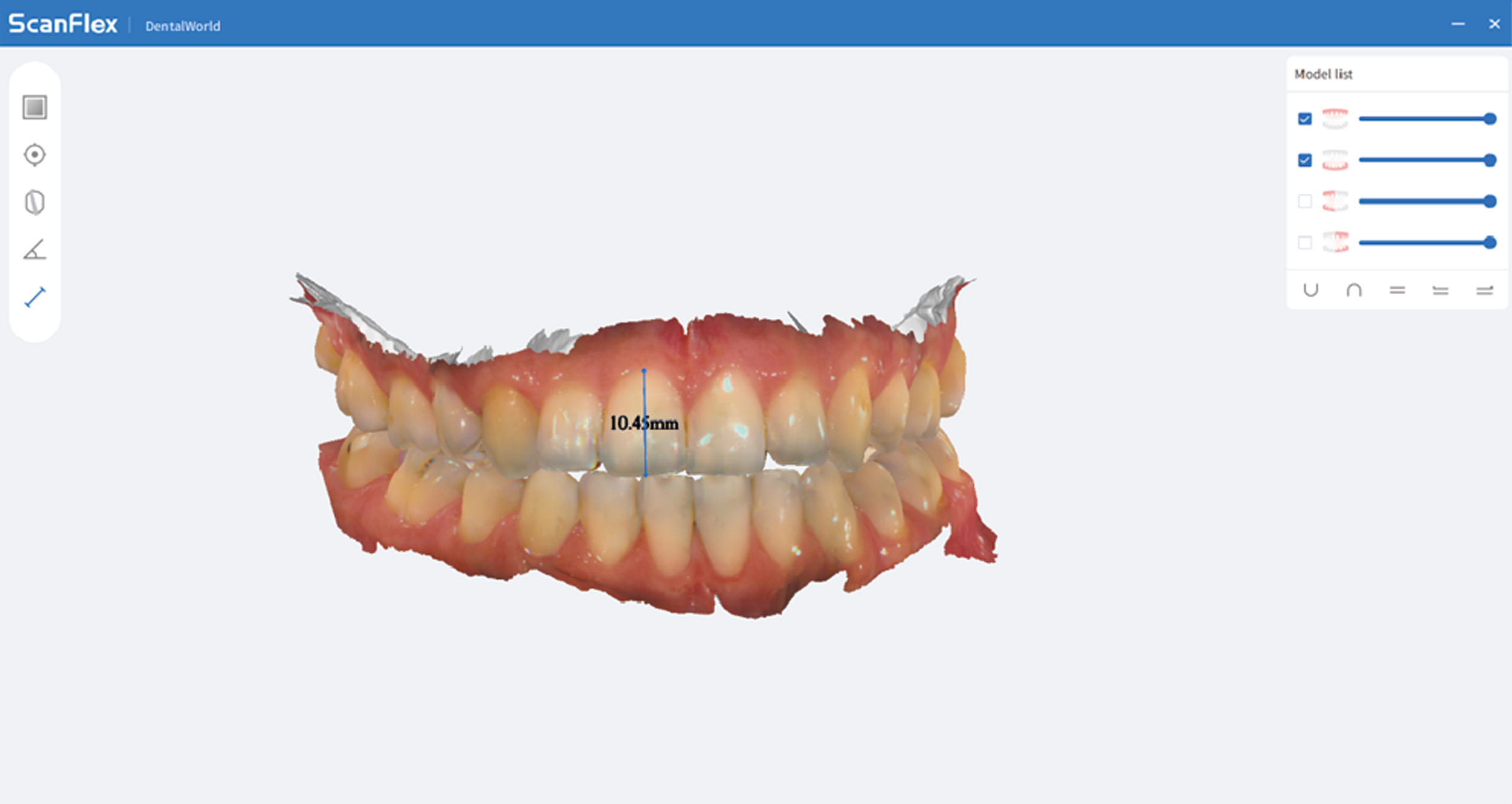 Escaner intraoral Fussen S6500