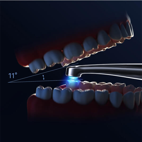 Modo Check de la O-Star PRO Woodpecker con luz violeta para detección de caries, sarro y fisuras